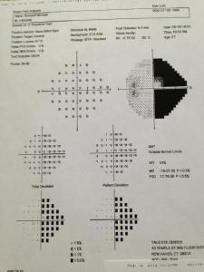 My visual field test of the other eye shows almost exactly the same amount of visual field