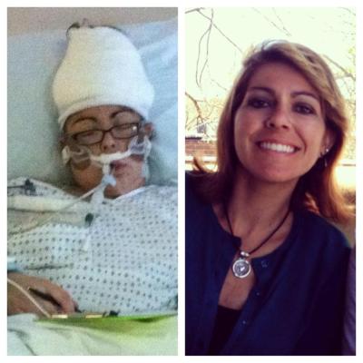 In the hospital post second brain surgery, June 2012 vs. May 3, 2013.  I don't even believe it sometimes.